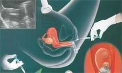 供卵试管的医院-试管代孕的大概费用_柬埔寨取卵-三代试管代孕一次成功_50多天