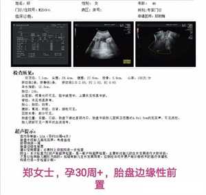 四川代怀孕可靠吗，四川省首例“第三代试管婴儿”在成都诞生